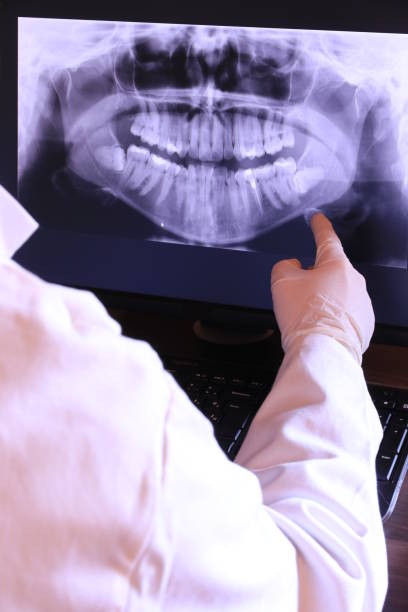 Best Broken Tooth Emergency  in Dellwood, MO
