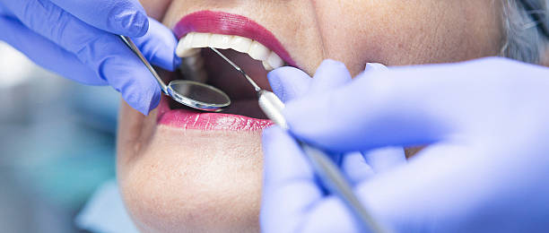 Best Cracked Tooth Emergency Dentist  in Dellwood, MO